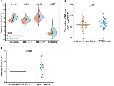 Elevated expression of LIF predicts a poor prognosis and promotes cell migration and invasion of clear cell renal cell carcinoma